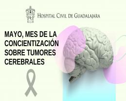 Detección a tiempo, paso clave en tratamiento de tumores cerebrales